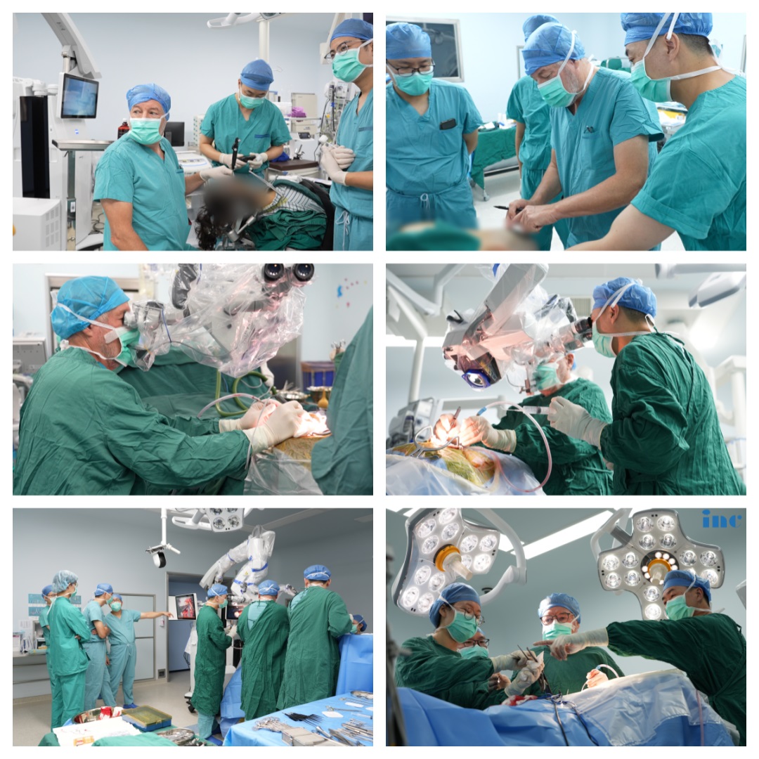 巴特朗菲手术图片