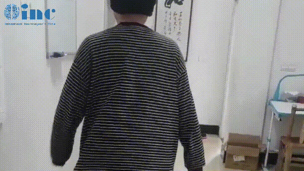 脑干胶质瘤患者康复案例