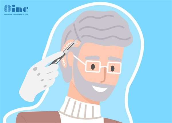 脊髓内肿瘤性病变伴出血