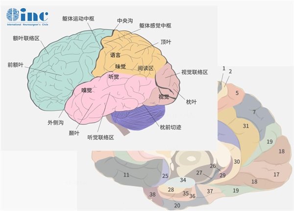 大脑松果体肿瘤切除成功