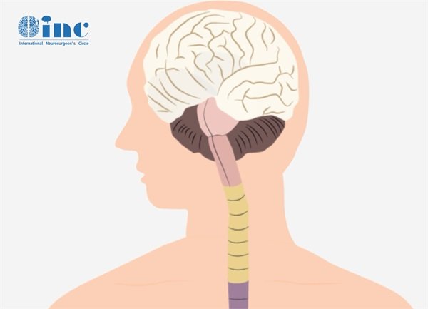 颅脑海绵状血管瘤SWI表现，主要有这几个方面！