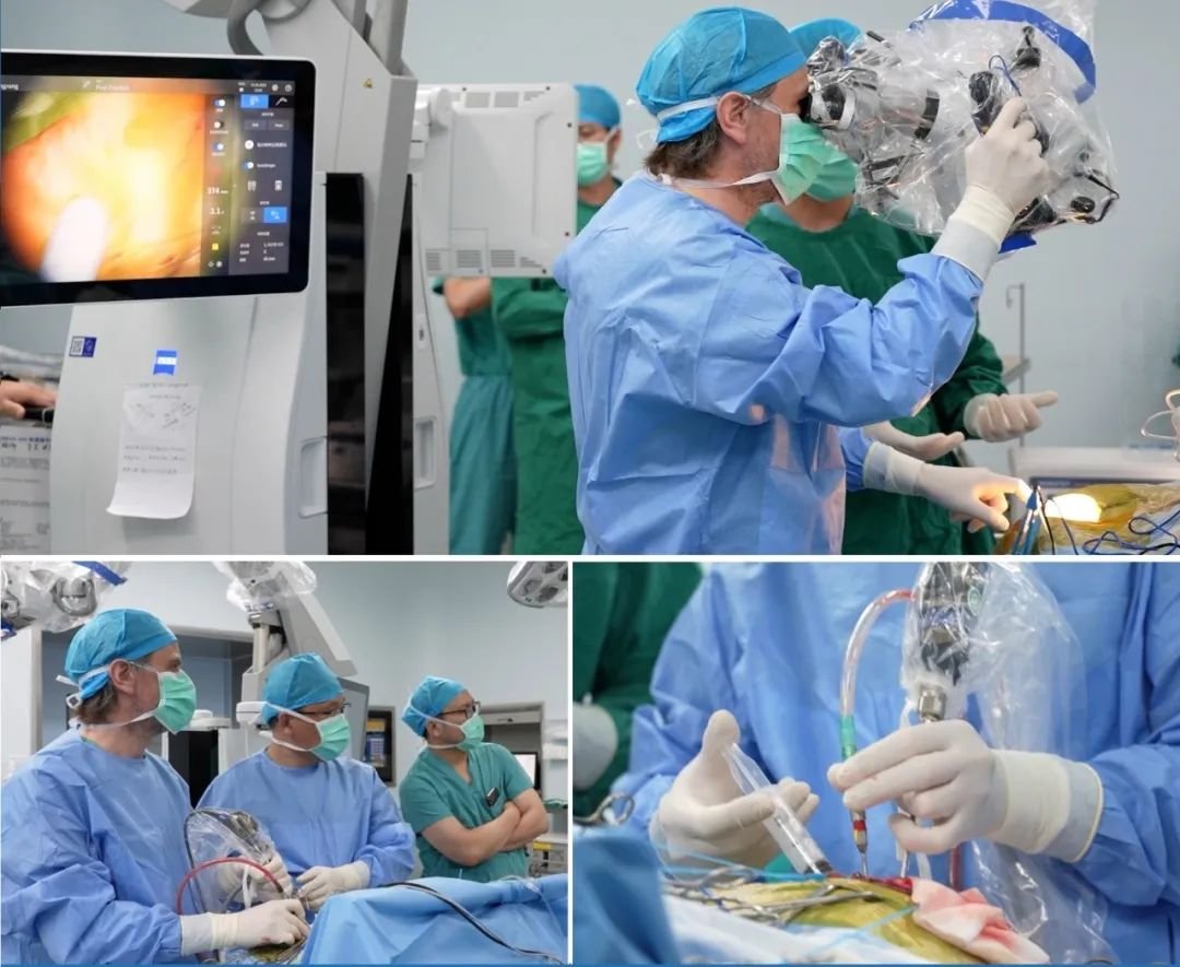 福教授使用神经内镜为一名脊索瘤患者进行手术