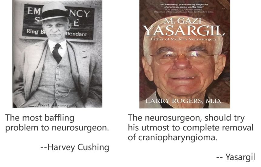 颅咽管瘤是神经外科医生较困惑的难题