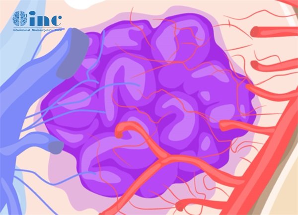 丘脑海绵状血管瘤出血2个月了还没吸收