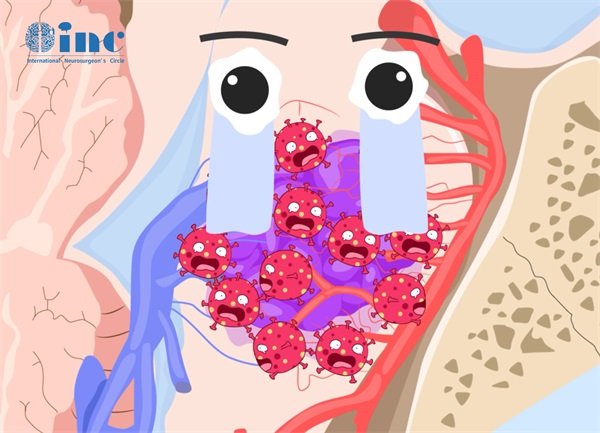 脑海绵状血管瘤哪里治疗好