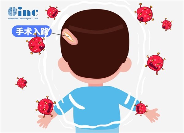 儿童脑部胶质瘤