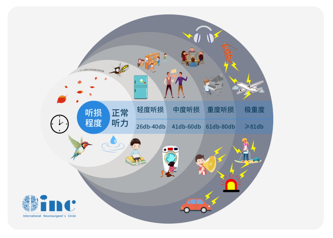 听神经瘤真实案例