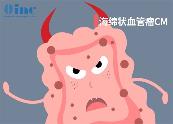 侧脑室海绵状血管瘤