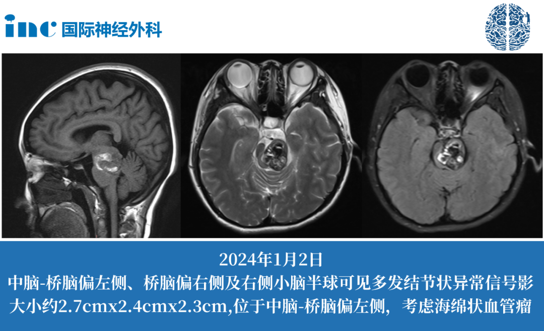 巴特朗菲教授来华