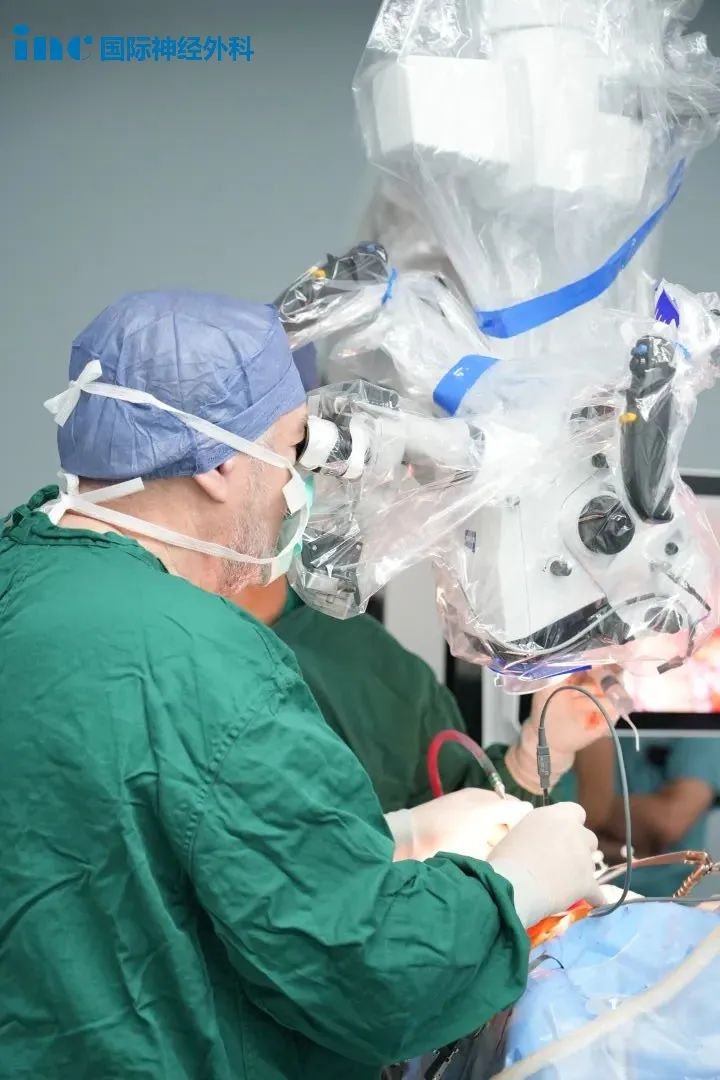 示范手术持续进行中，26岁女性基底节海绵状血管瘤成功手术
