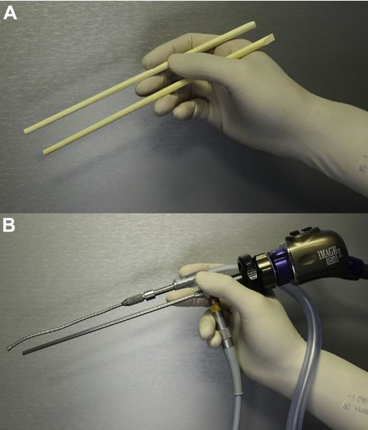 图示为筷子技术，A图表示筷子夹在拇指和手指之间。B图表示内窥镜和抽吸（或其他器械）可以类似地保持在外科医生的非主导手中。旋转轴与抽吸尖端的远端角度结合可以将小手指运动转换成暴露深度中的360度范围。