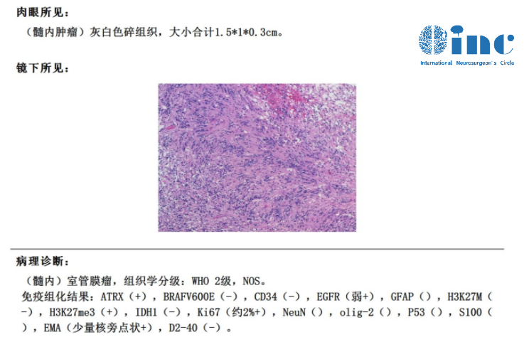 巴教授术中纪实