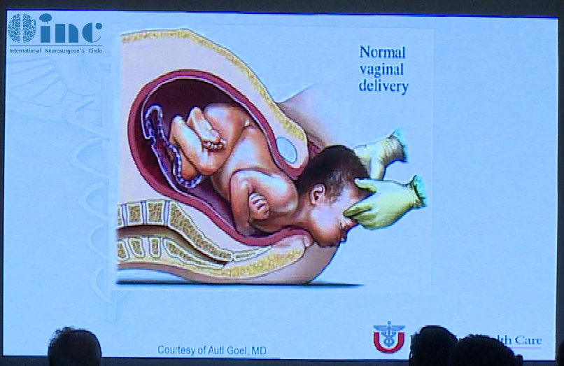 演讲中教授以人体产道类比鼻下经蝶入路的天然优势