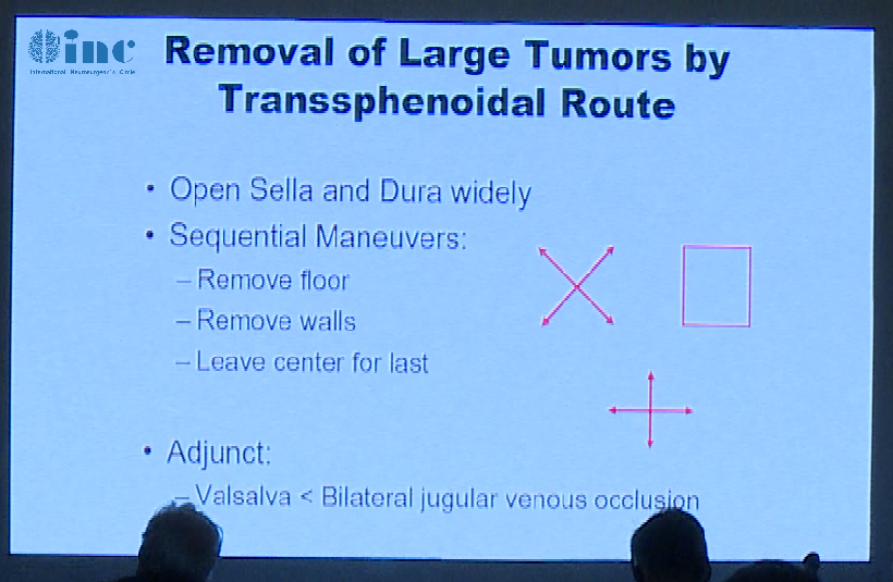 打开Sella和Dura widel；顺序机动；拆下地板；删除墙；然后离开中心；辅助；Valsalva双侧颈静脉闭塞