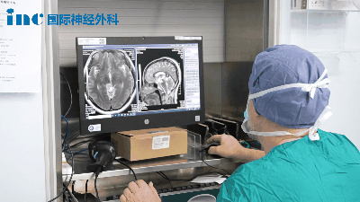 查看影像、调节显微镜……巴教授细致做术前准备