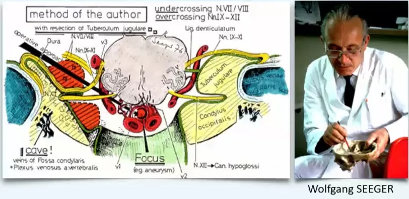 INC巴特朗菲教授导师Seeger教授手绘枕骨大孔区