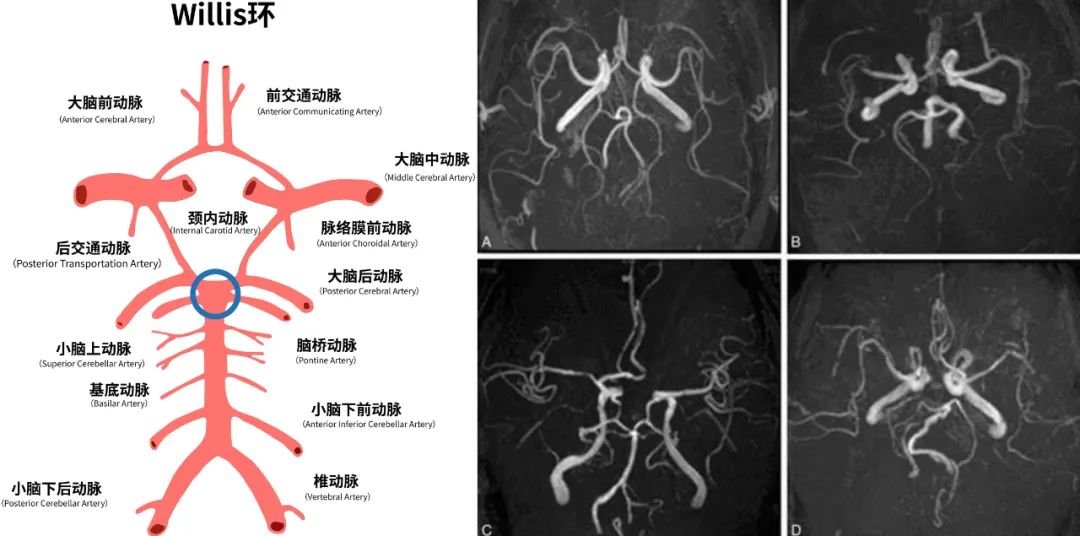 颅咽管瘤的手术成功率高不高？风险大吗？