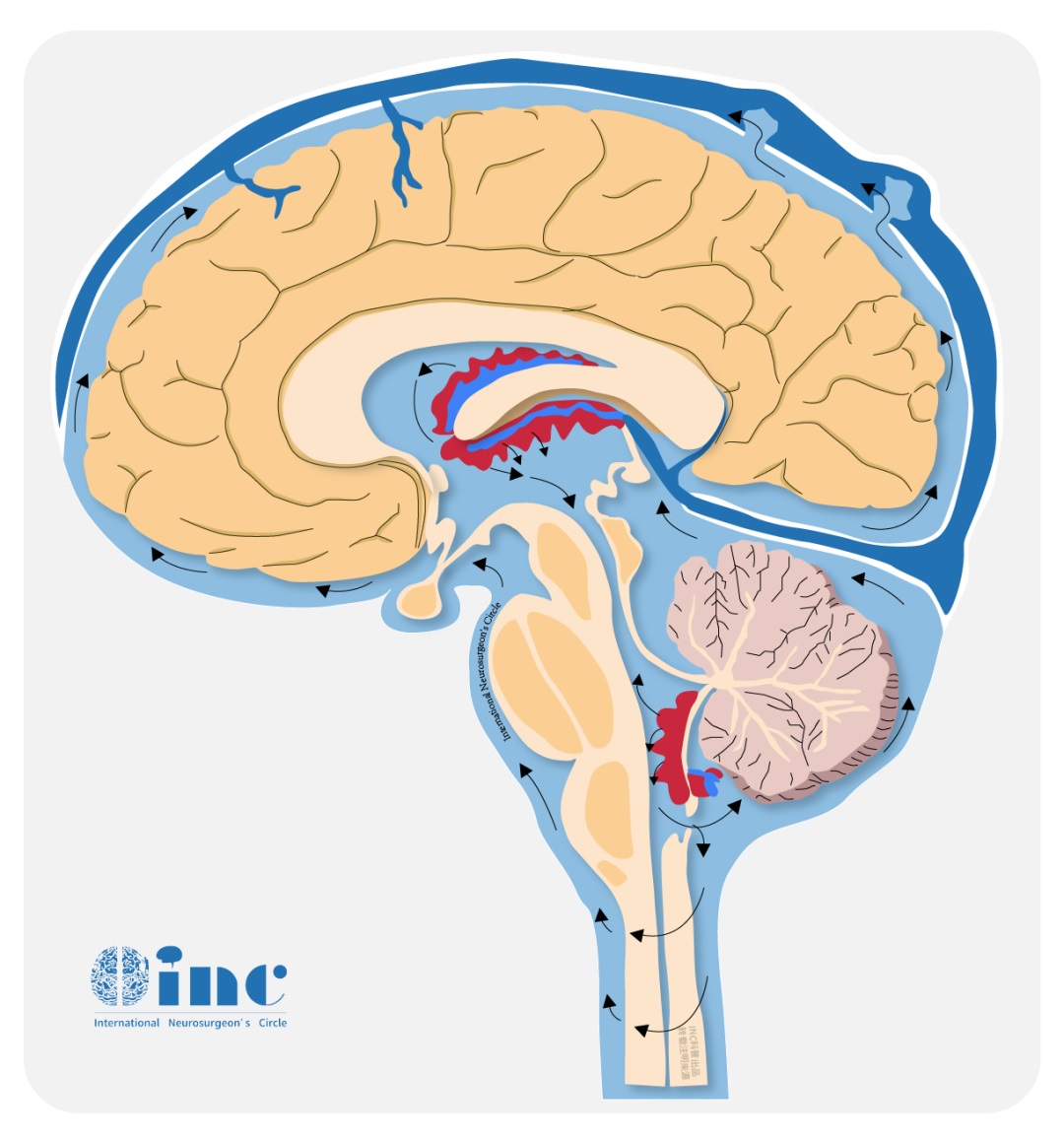 ​8岁男孩罹患少见脑瘤