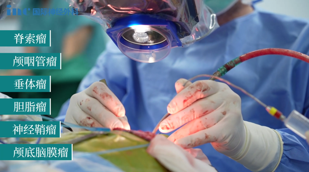 INC法国福洛里希教授