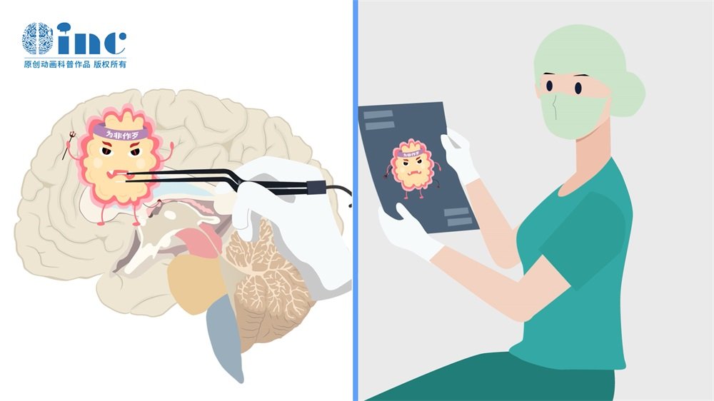 枕叶胶质母细胞瘤