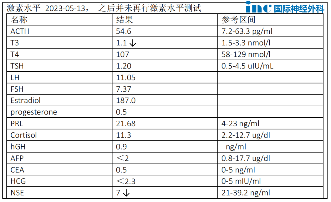 视神经-下丘脑区较大胶质瘤案例