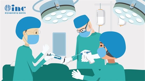 颈椎延髓胶质瘤手术成功率如何？