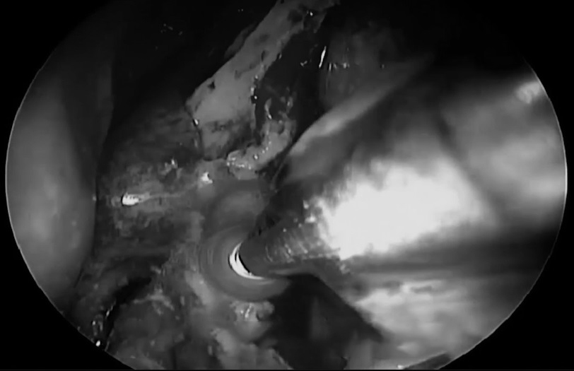 从上面用45度角度镜向下看，有时候是70度