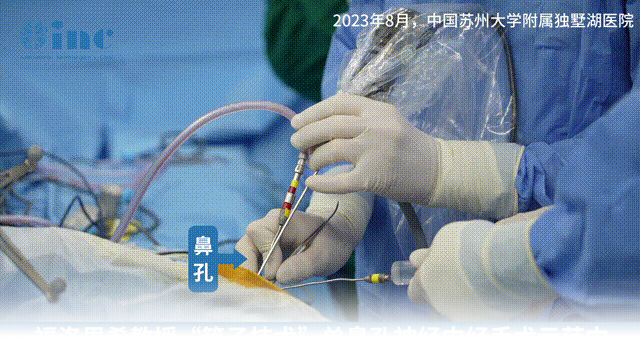 儿童鼻内镜手术比成人更难，为何？