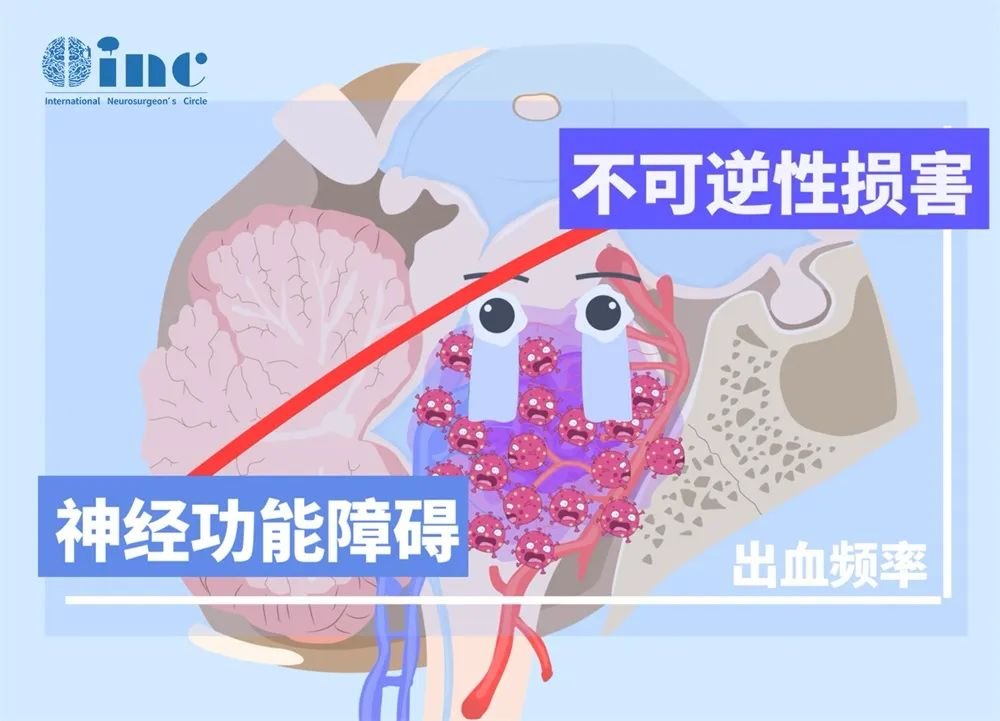 危险的脑干海绵状血管瘤出血