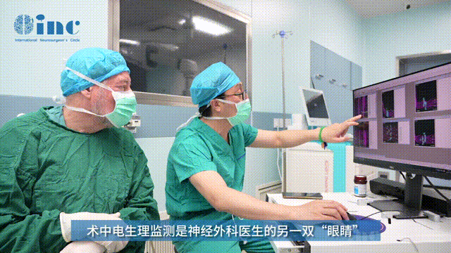 神经电生理监测