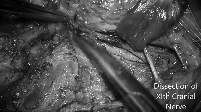 识别并解剖十一颅神经