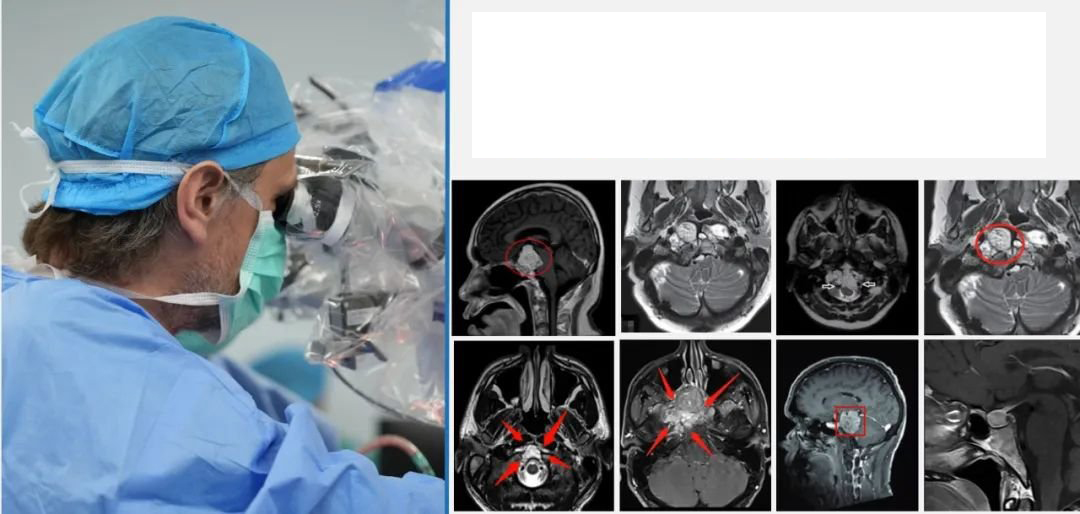 INC法国福洛里希教授  　　部分精彩案例交流