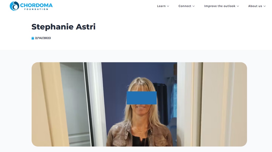 脊索瘤患者图片