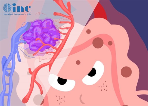 11型海绵状脑血管瘤是什么