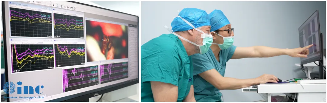 巴教授示范手术中一名丘<a href='/bingzhong/xueguanliu/' target='_blank'><u>脑海绵状血管瘤</u></a>患者的监测过程