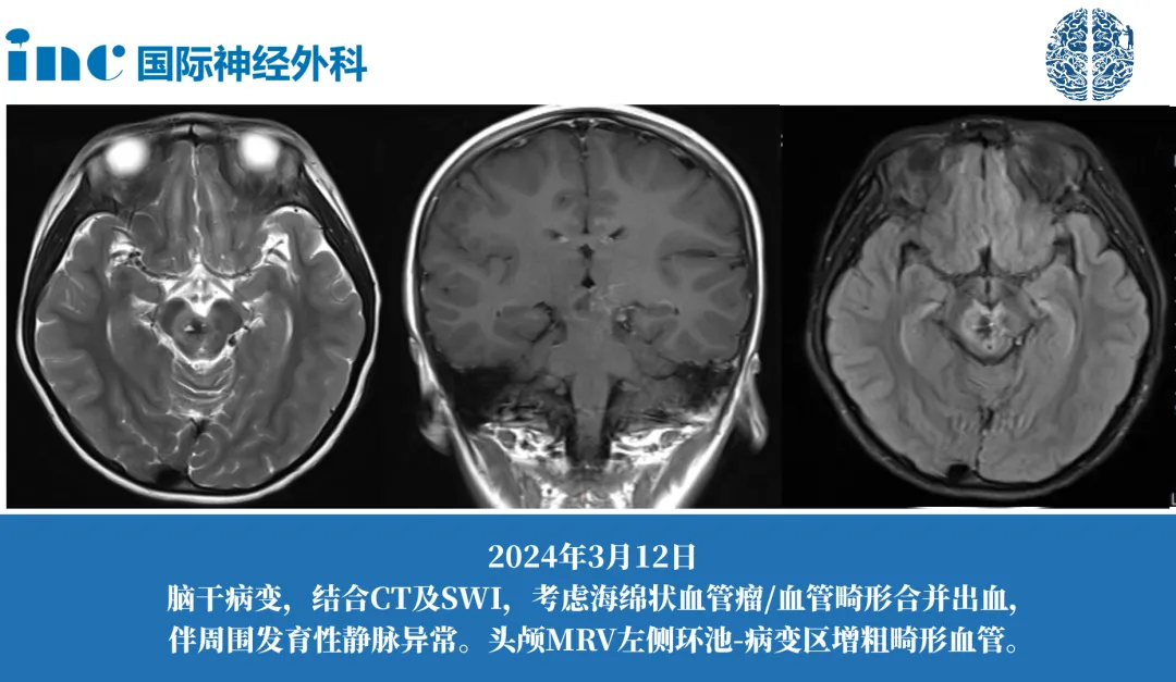巴教授到国内苏州约的到他吗——巴教授案例图片
