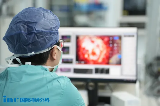 脑海绵状血管瘤患者手术案例——电生理监测