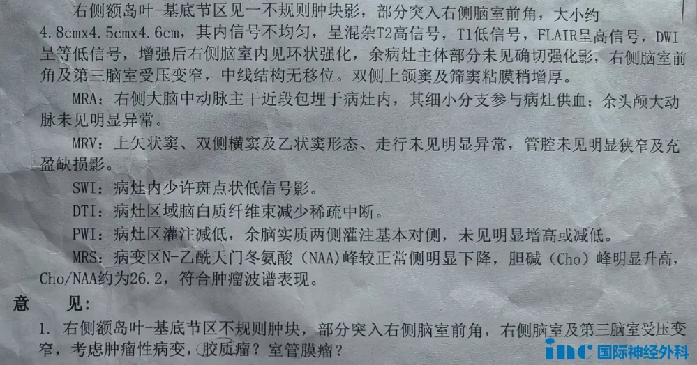 16岁男孩--基底节胶质瘤