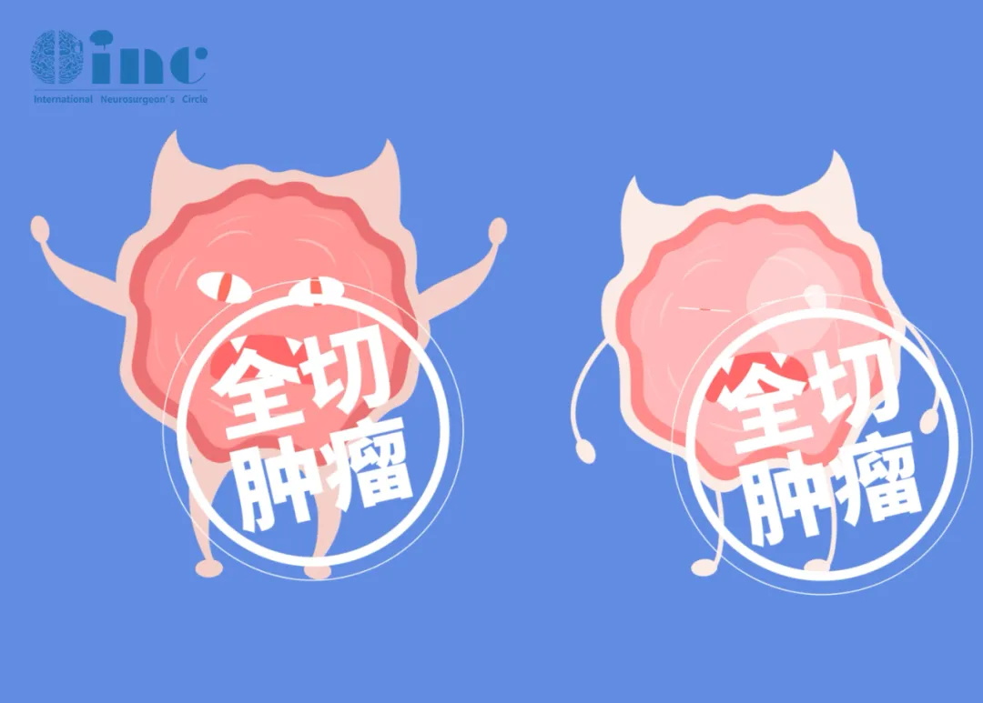 为什么脑膜瘤明明“全切”了