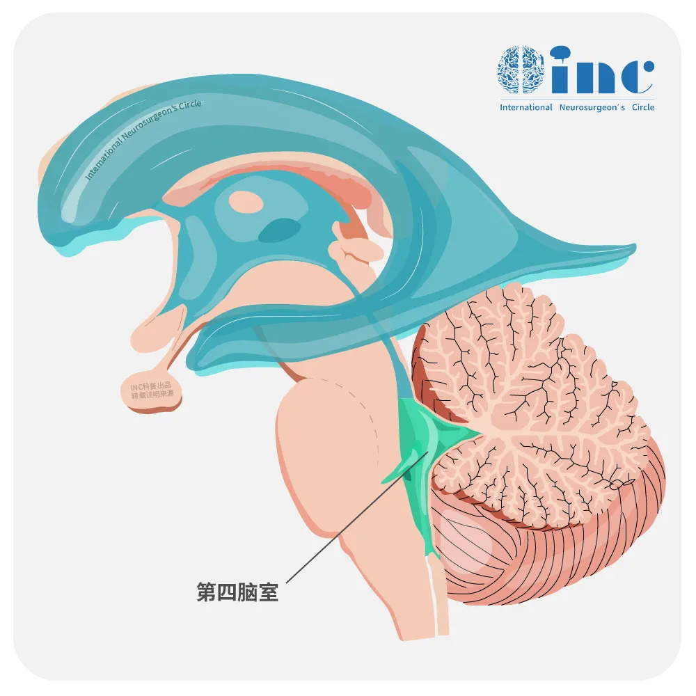 四脑室图片
