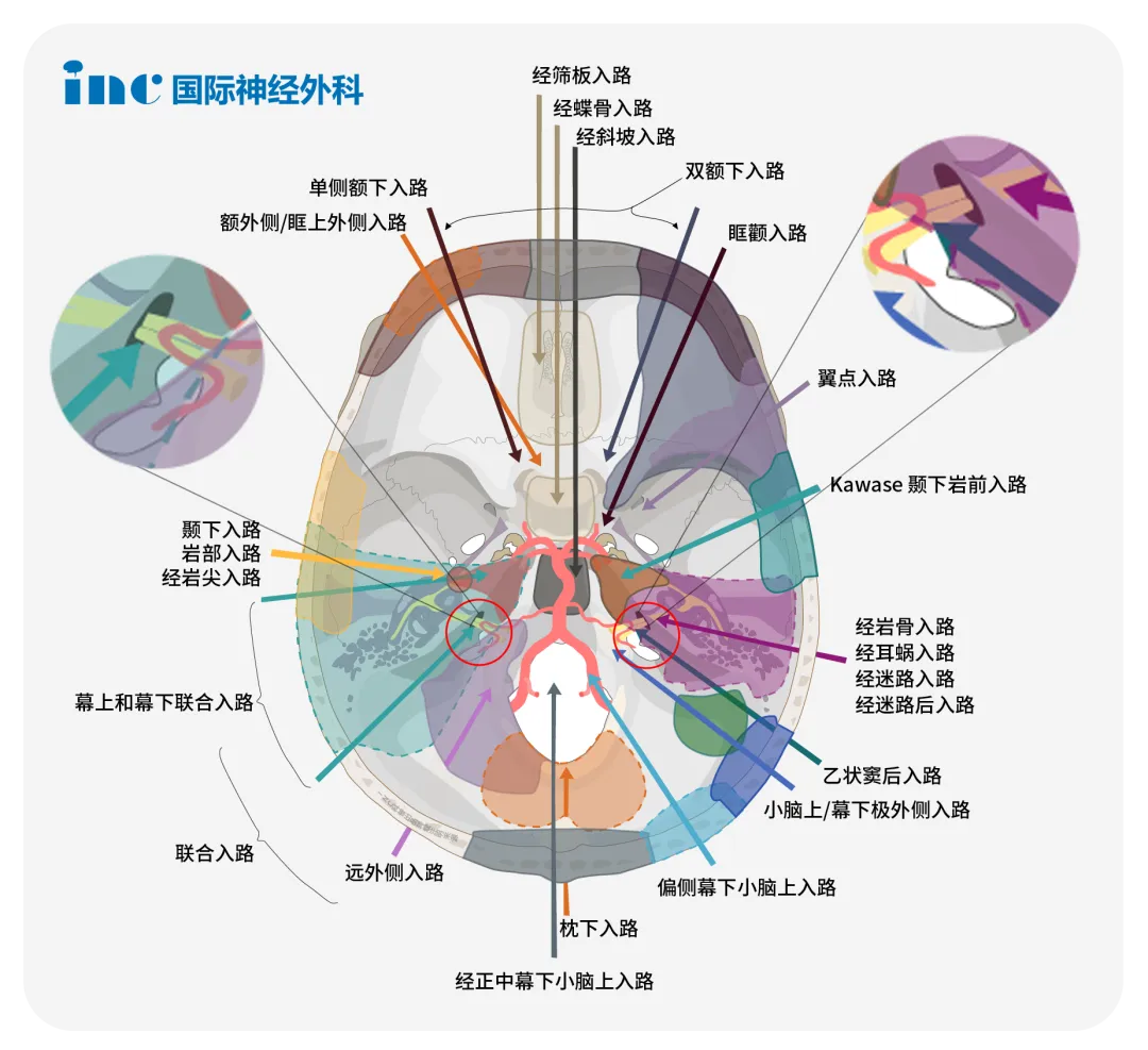 颈静脉孔区肿瘤的症状是什么