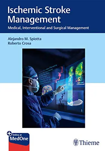 2、Ishemic Stroke Management:Medical,Interventional and Surgical Management
