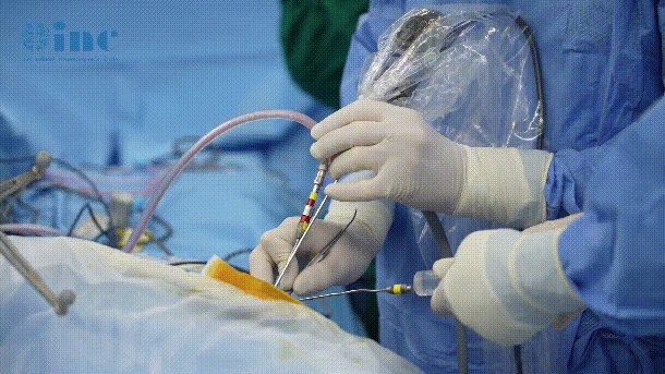 福洛里希教授使用神外内镜“筷子手术”单鼻孔入路为林林除肿瘤