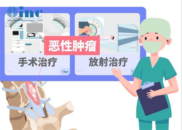 petct能查出脊髓肿瘤吗