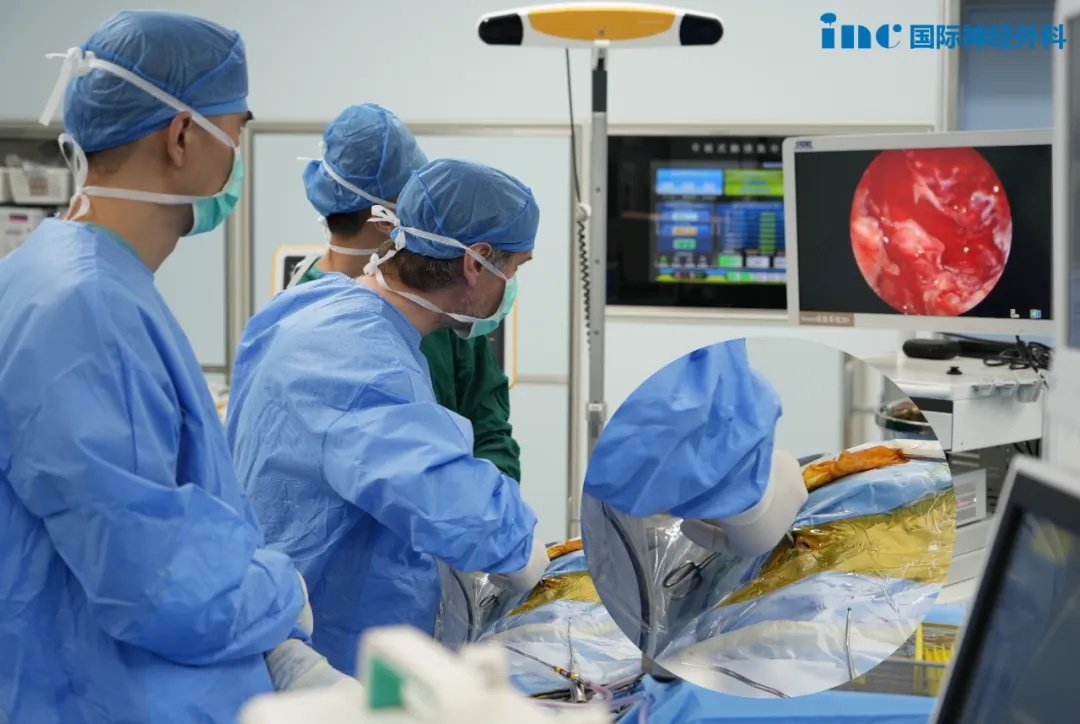 微创经鼻内镜手术