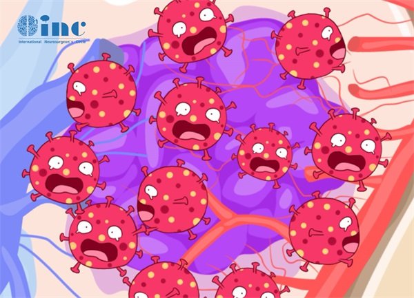 脑海绵状血管瘤ct影像表现?