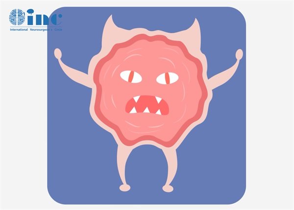 扁平型脑膜瘤的手术难度如何?