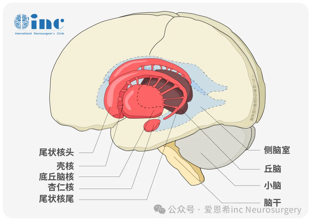 小脑缄默综合征（cerebellar mutism syndrome，CMS），又称后颅窝综合征