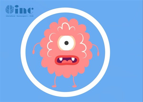 菊形团形成性胶质神经元肿瘤能治好吗？治疗方法？