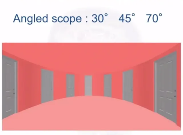 在狭窄通道的手术中，必须采用弯曲并带有角度的器械，通过旋转可以深入到侧面和角落。福教授可熟练运用30度、45度甚至70度角的内镜，此外，福教授也在积极研发相关器械。